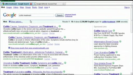 SEO service? No need with these pro SEO training videos.