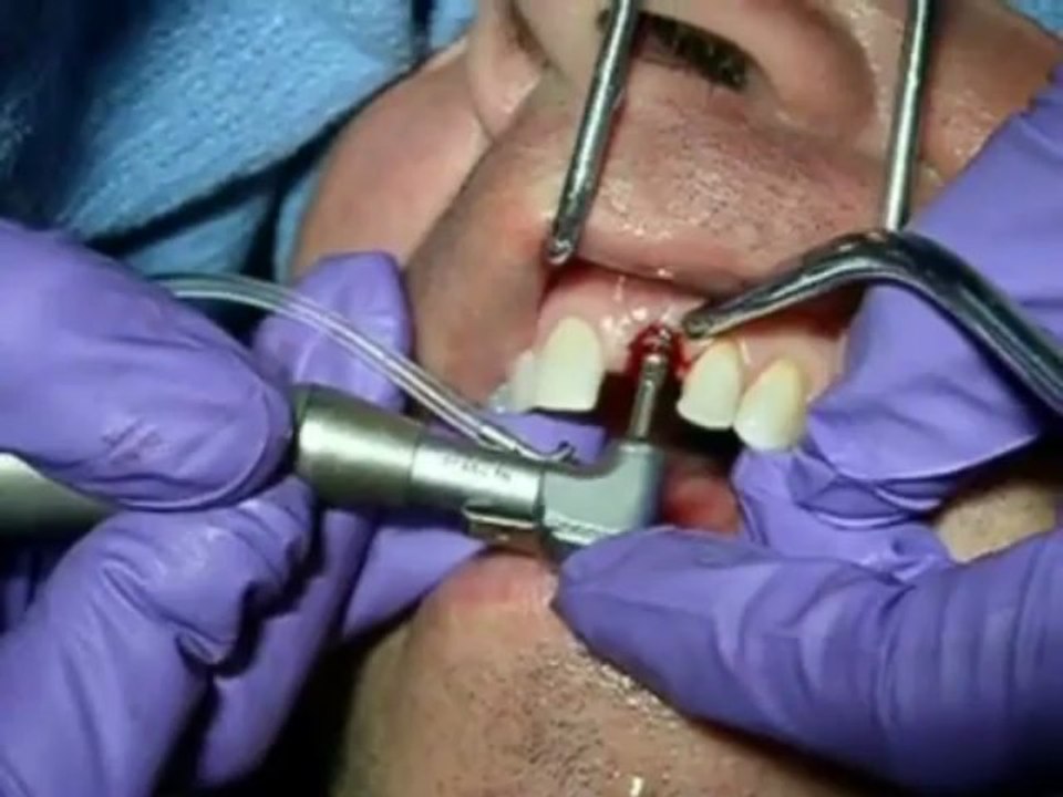 Dr Rodney Aziz - Teeth Surgery- Dr Rodney Aziz