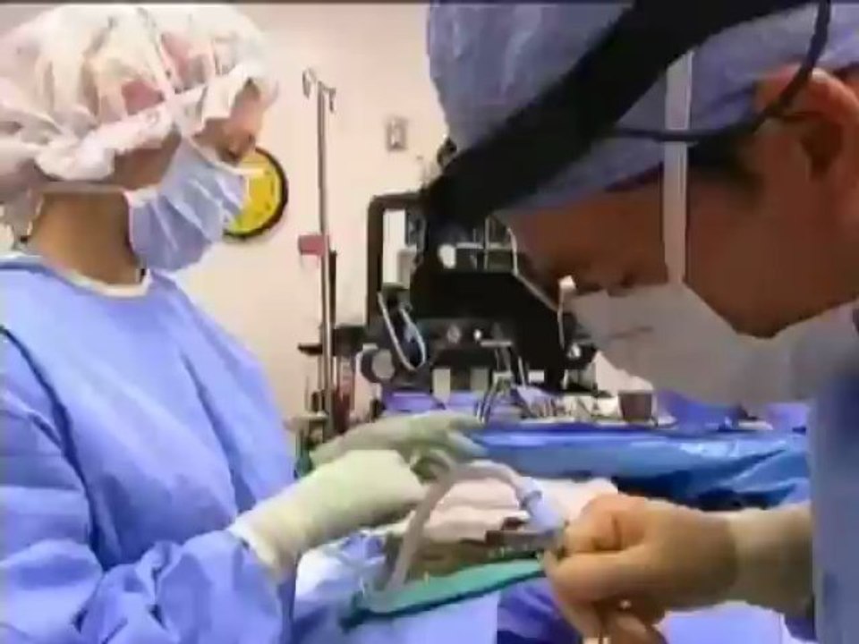 Dr. Jason Diamond Reviews Deviated Septum and Rhinoplasty on Dr 90210