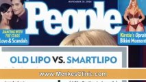 SmartLipo Los Altos - The Menkes Clinic