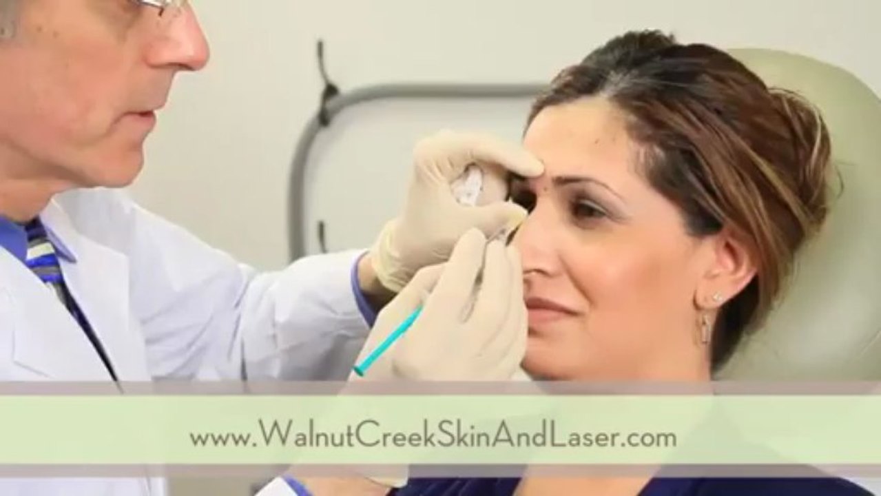 Botox Walnut Creek CA - Walnut Creek Skin & Laser