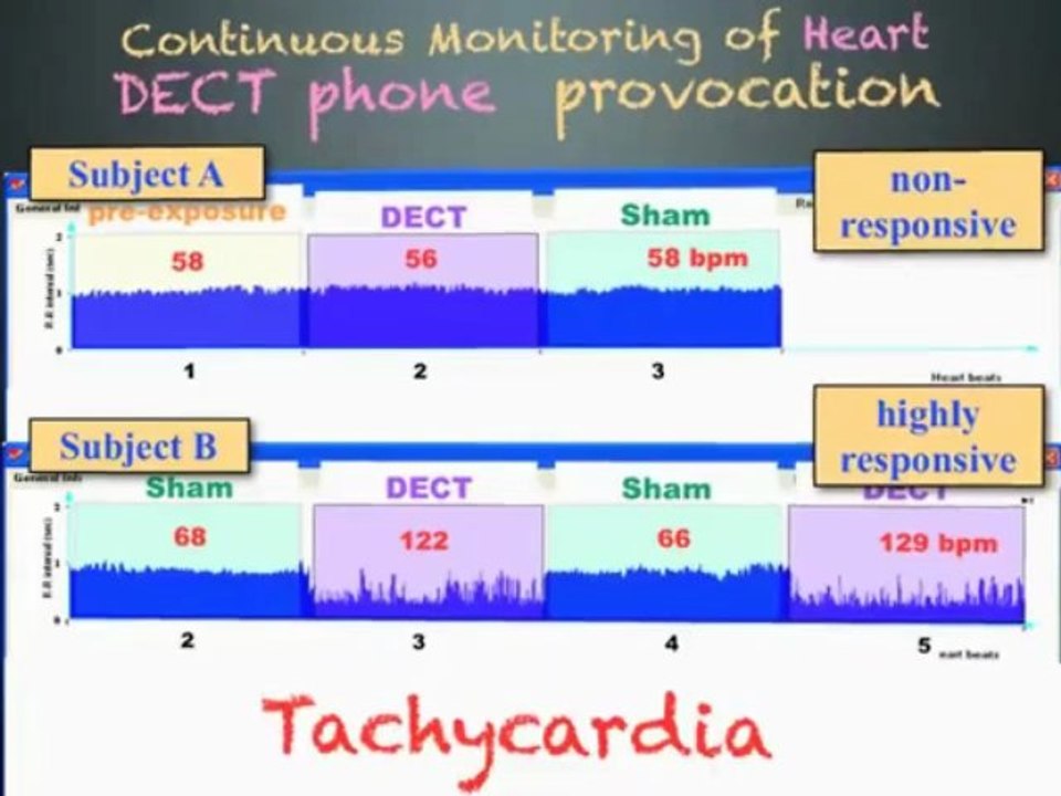 Cell Phones Cause Cancer, Electromagnetic Pollution