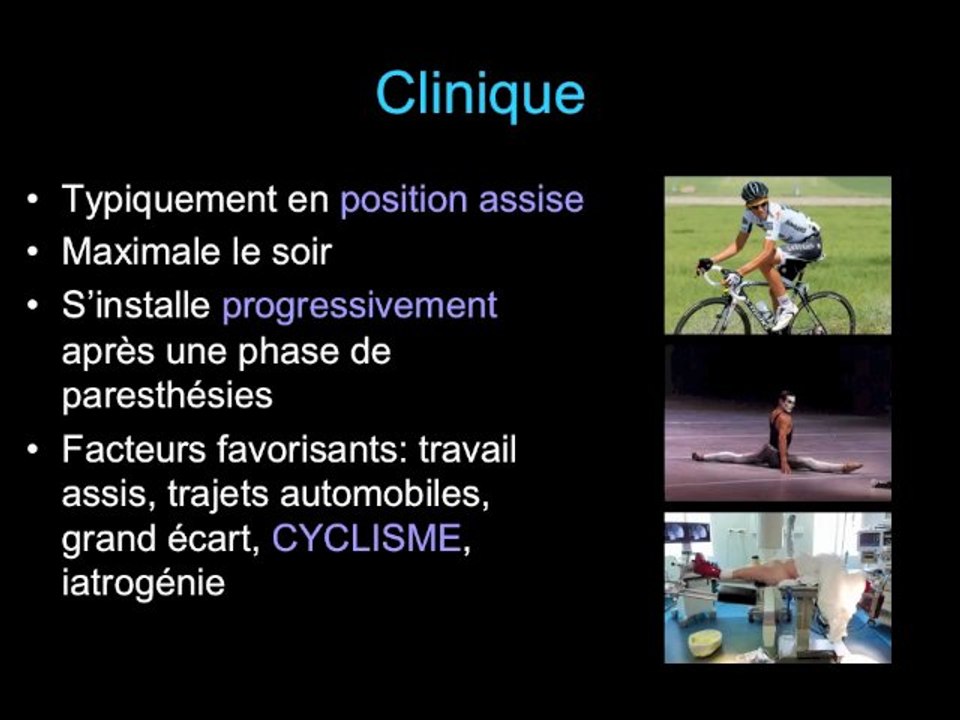 Syndrome d'Alcock
