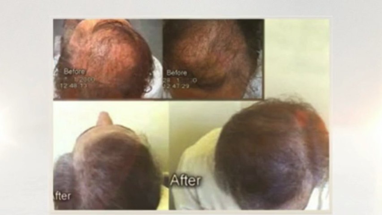 Hair Treatment