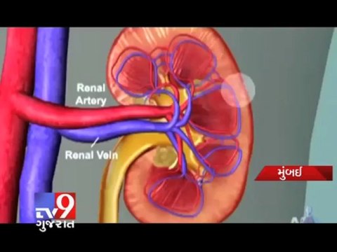Tv9 Gujarat - First domino kidney transplant in India