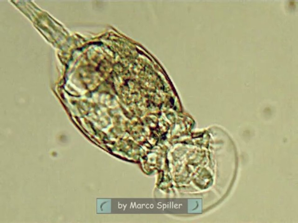 Squatinella
