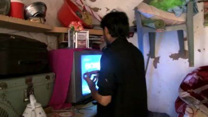 Pakistani actress burned in acid attack