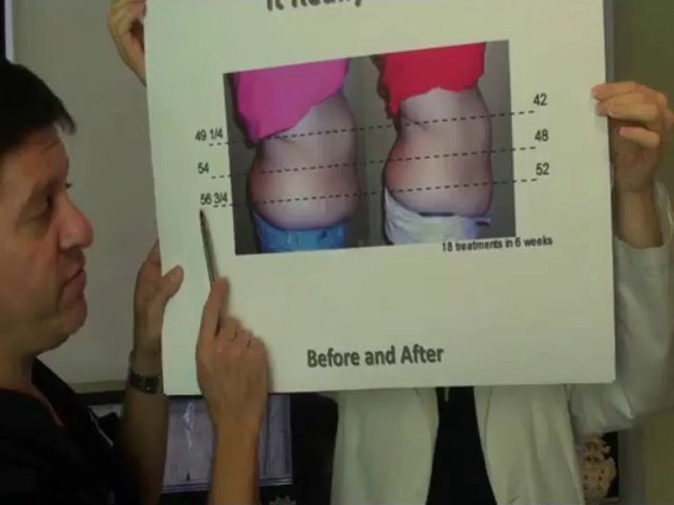 Rockville Chiropractors Weight Loss Program Before and After Pics