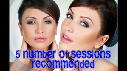 Facts About Laser Hair Removal