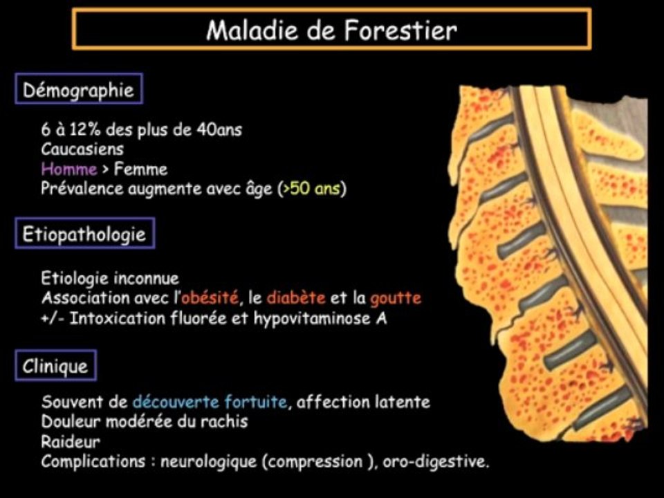 Un cas de dysphagie