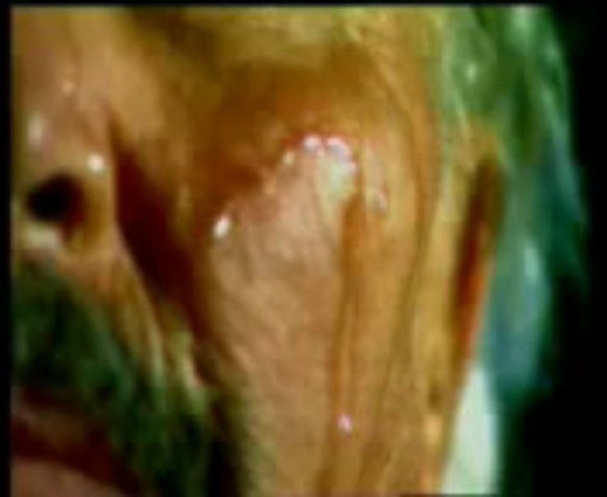 Haluk Özkan - Dermanım Ali