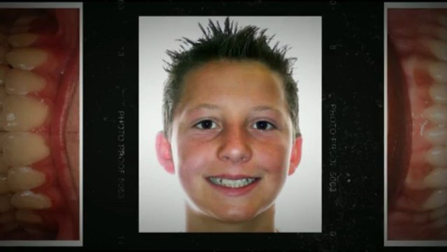 Braces Colorado Springs May2013