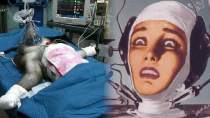 Science is Almost Ready to Give You a Head Transplant