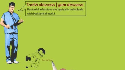 Tooth abscess