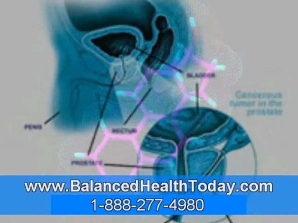 Enlarged Prostate Causes, Prostate Health