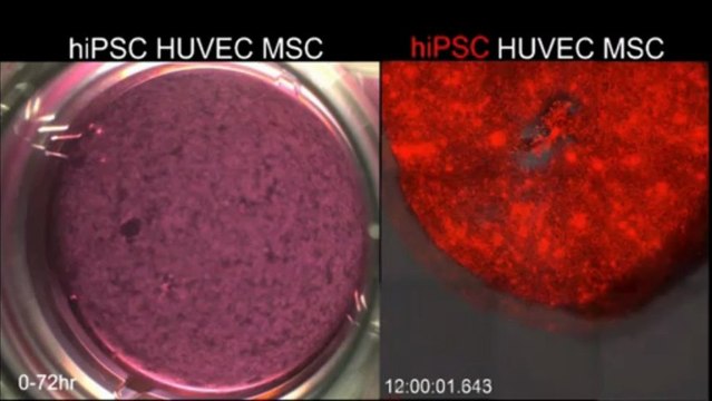 formation d'un foie humain à partir de cellules souches induites.