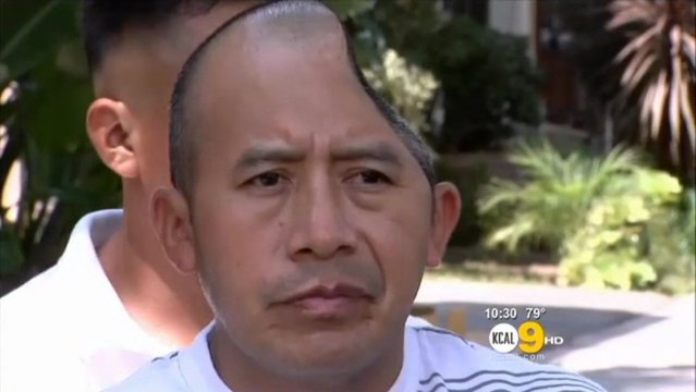 Il a perdu un quart de son crâne : il reçoit 58 millions de dollars