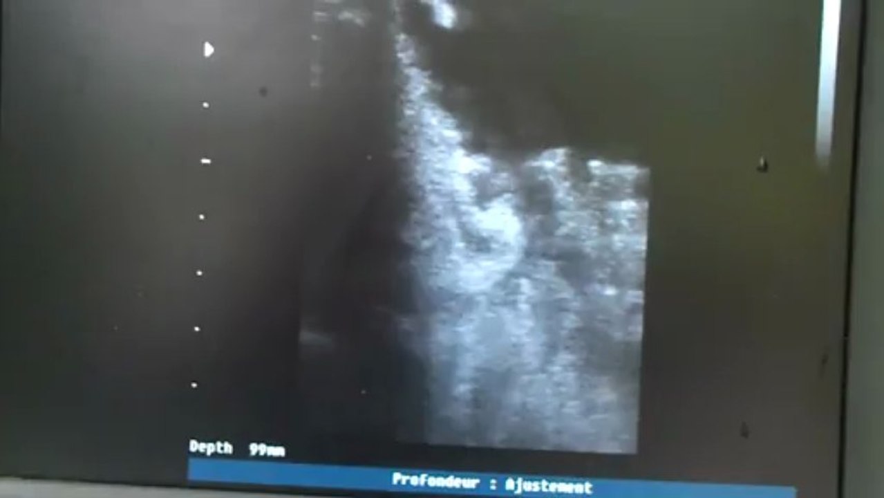 Echo 03/07/2013