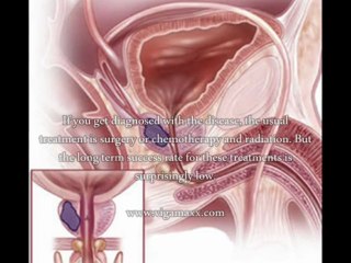 Prostate Health Product - What Is The Best Prostate Health Product In US?