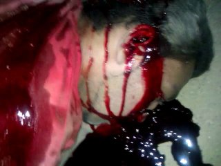 Accident @ Airport Flyover KHI (Use Helmet Save Ur Life)