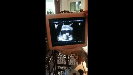 Deuxiéme échographie: 18SA  / Jennifer et Damien