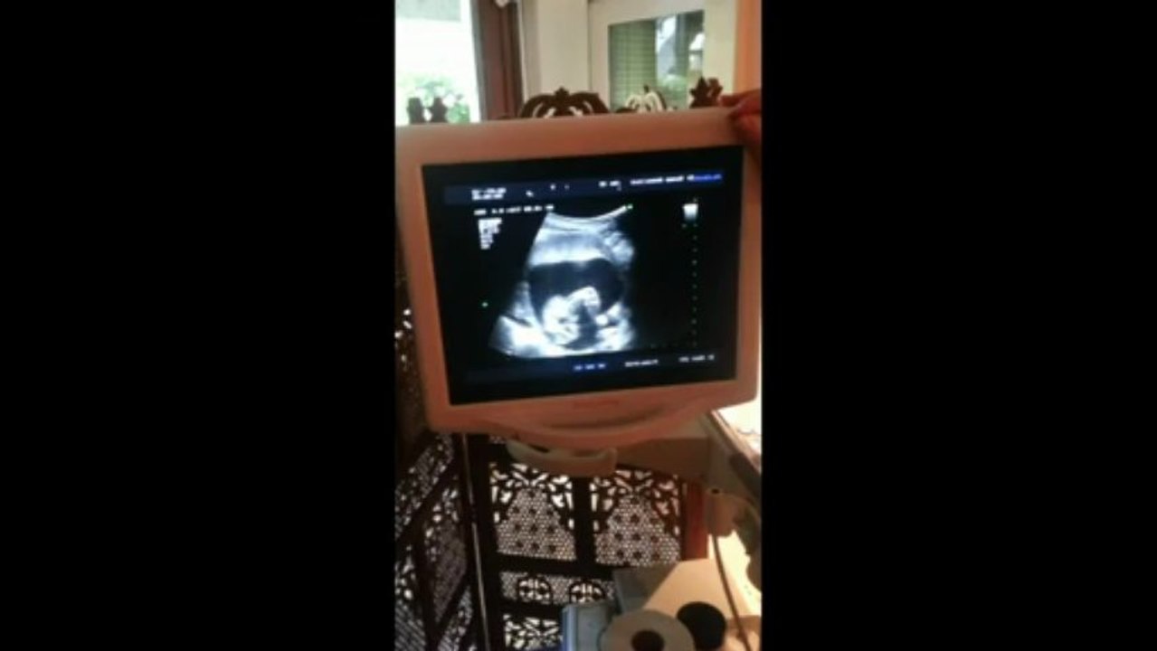 Deuxiéme échographie: 18SA  / Jennifer et Damien