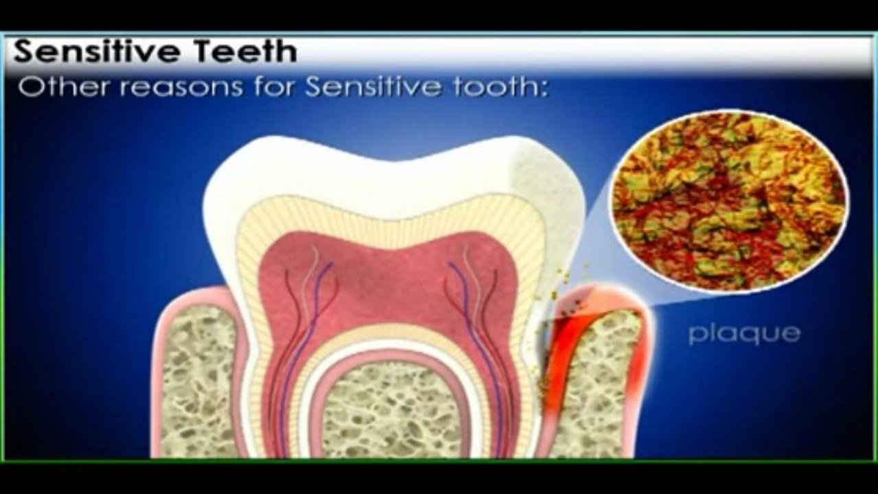New Line Smile Network: Dental Treatment