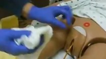 CNA Training Catheter Care