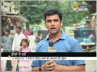 Cleft lip - The pain of smile