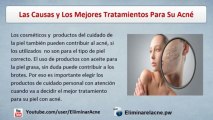 Acne  - Las Causas y Los Mejores Tratamientos Para Su Acne