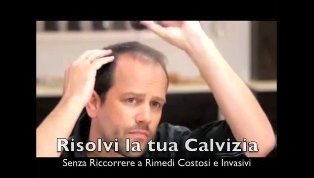 Soluzione DIRADAMENTO CAPELLI, parrucche, trapianto capelli, stempiature
