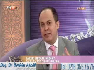 Lazer lipoliz nedir