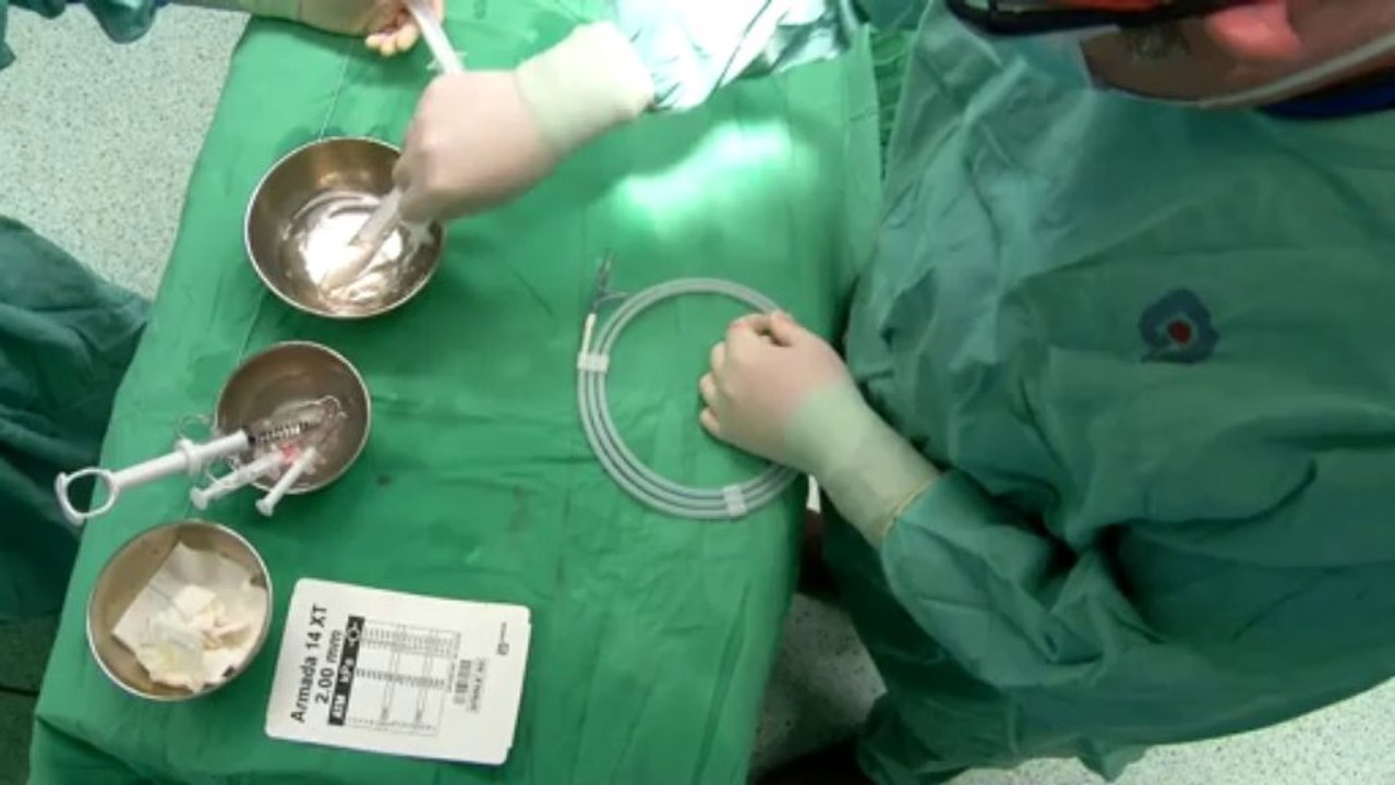 Endovascular rescue of a distal bypass at risk