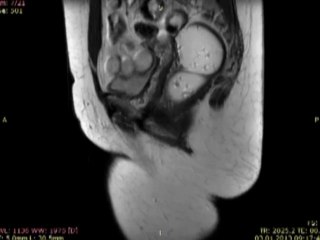 Kayıhan Günay  MR Dekografi