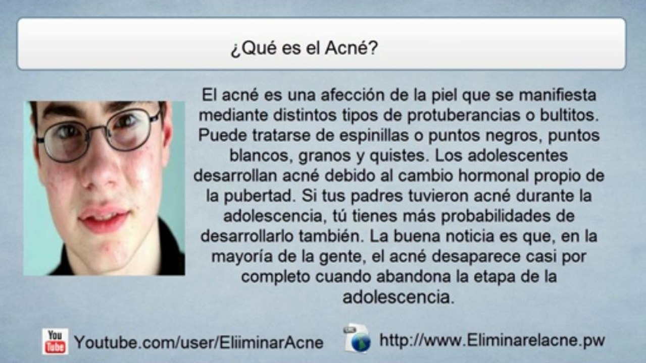 Que es el Acné