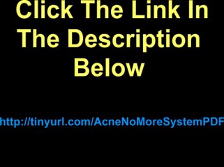 Acne No More Ebook Acne No More System