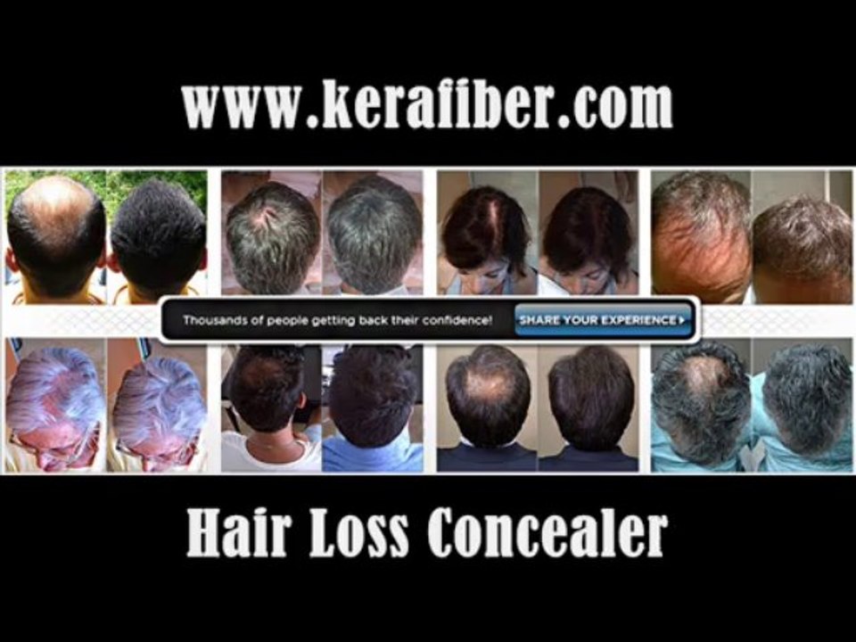 Hair Loss and Bald Spot Concealers