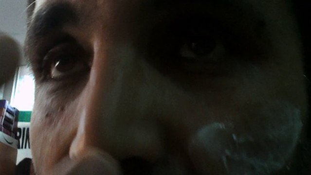 DENEYLER İLE TÜY NASIL YOK OLUR VE ÇIKAR KOBAY ABDULLAH KIZILAY KOZMETİK BANK