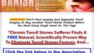 Banish Tonsil Stones Download + Does Banish Tonsil Stones Really Work