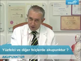 Yüz felci ve diğer felçlerde akupunkturun başarı oranı nedir ?