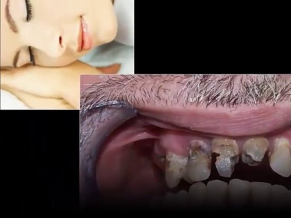 Cosmetic Dental Work Calgary - Call (877) 927-2387
