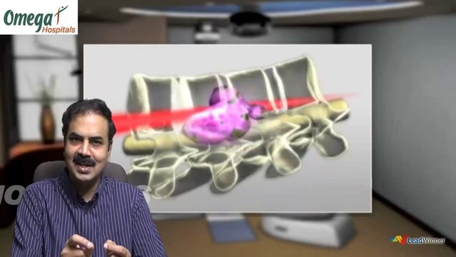 Cancer Doctors in Hyderabad | Cancer Surgeons in India | Best Cancer Doctors in India: Omegahospitals.com