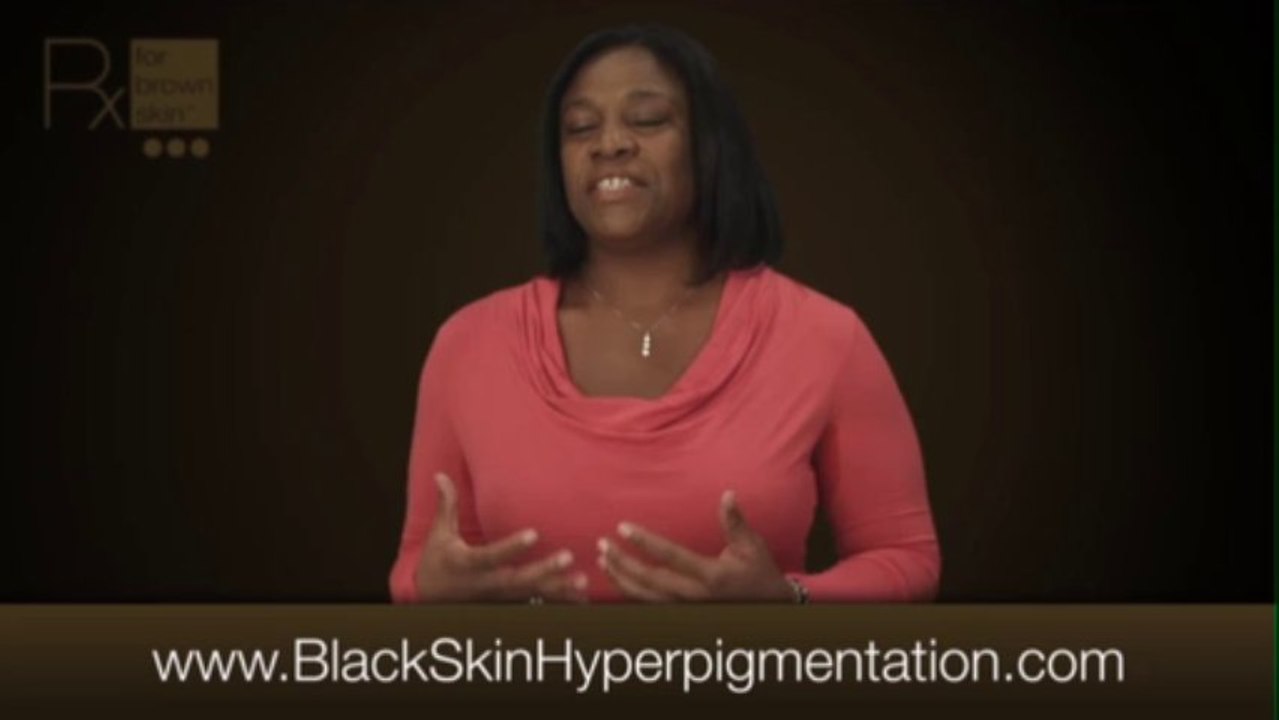 treating hyperpigmentation in dark skin- RX for Brown Skin