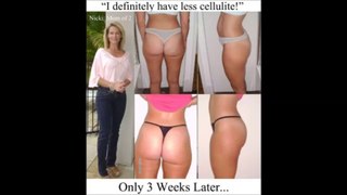 Change Your life with (The Truth about Cellulite)