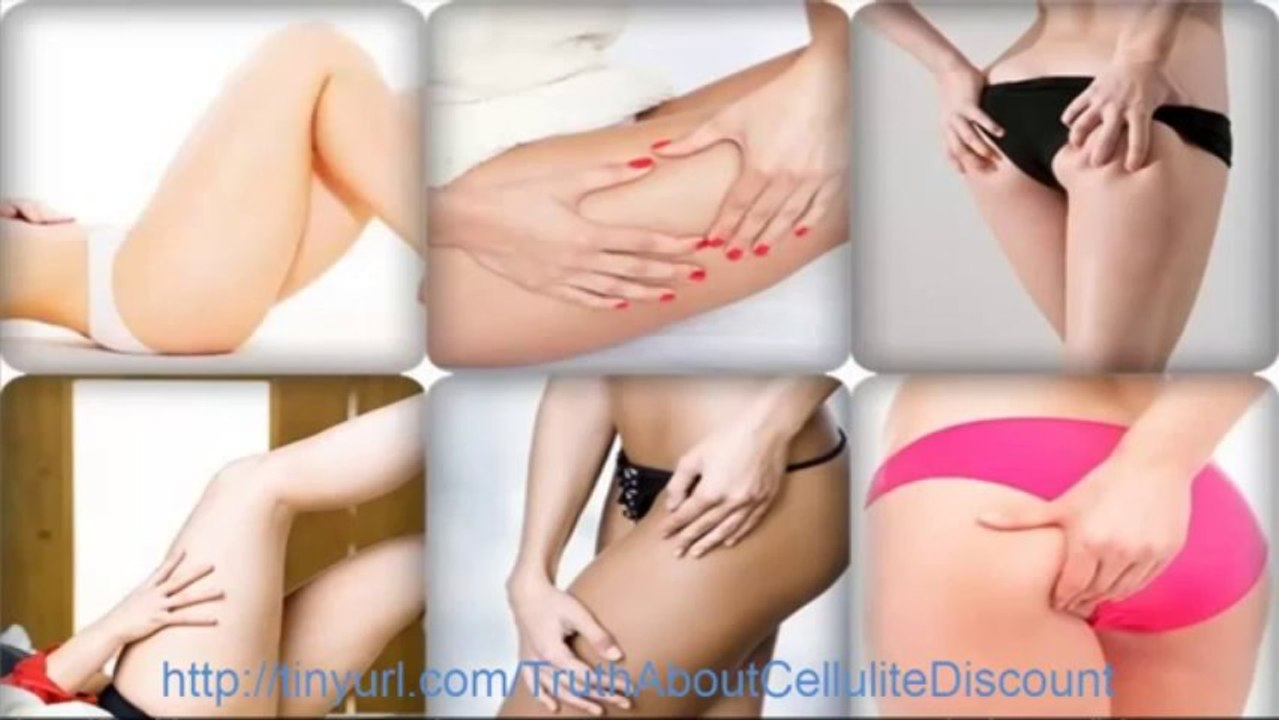 Truth About Cellulite Review   Is Truth About Cellulite Any Good or Scam 