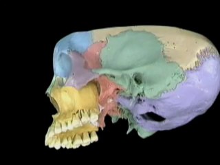 Acland&#39;s Video Atlas of Human Anatomy: Sphenoid Bone