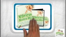 VARICES NUNCA MAS | LA SOLUCION NATURAL PARA ELIMINAR LAS VARICES