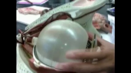 Human Anatomy 361 - Eye model