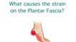 Heel Pain, Heel Spurs and Plantar Fasciitis explained...