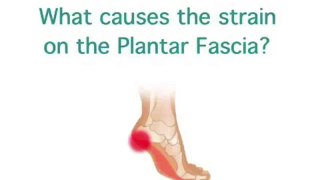 Heel Pain, Heel Spurs and Plantar Fasciitis explained...